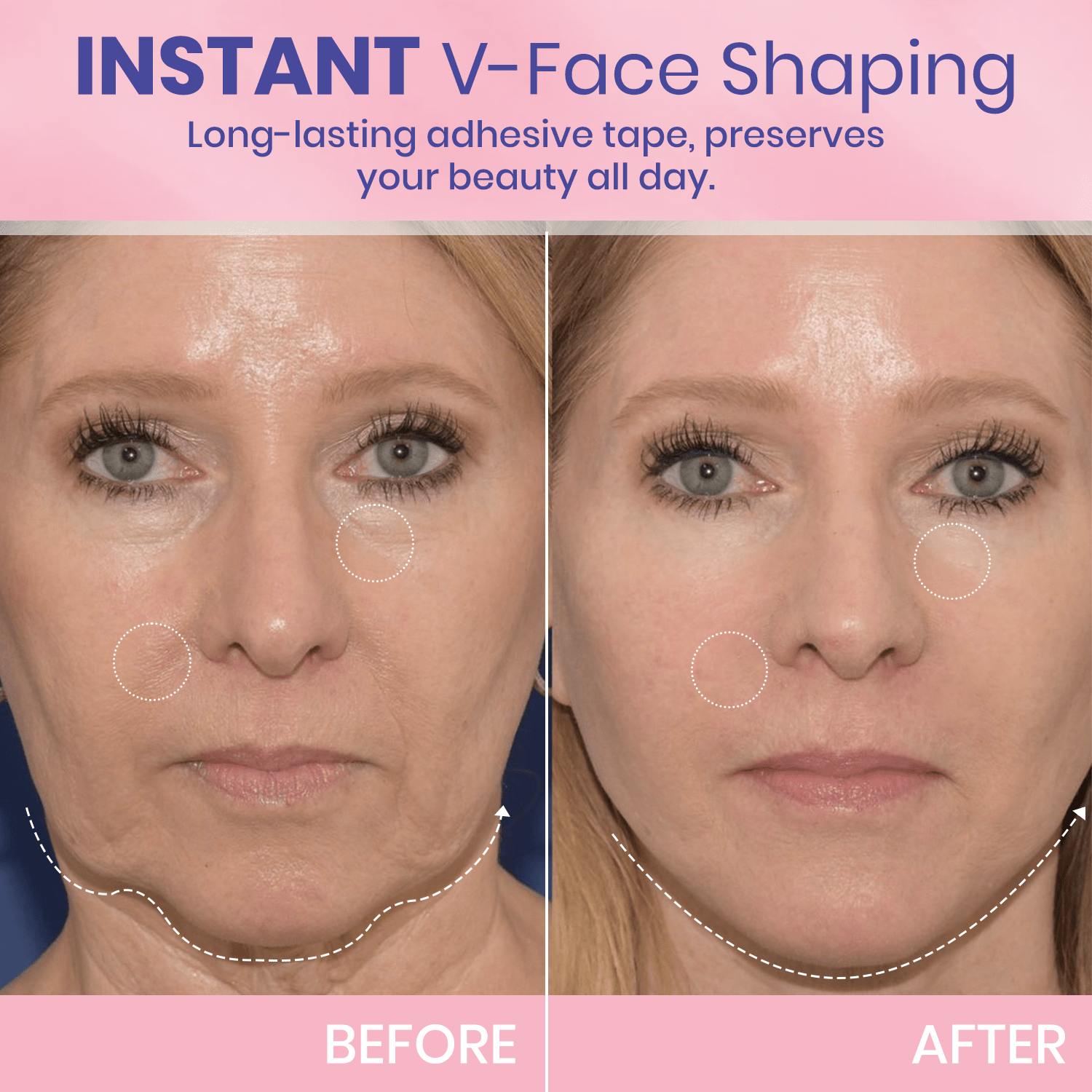 💖🎁Posledný deň so zľavou 50 % – neviditeľná lepiaca páska Aweiya™ V-Face Lifting